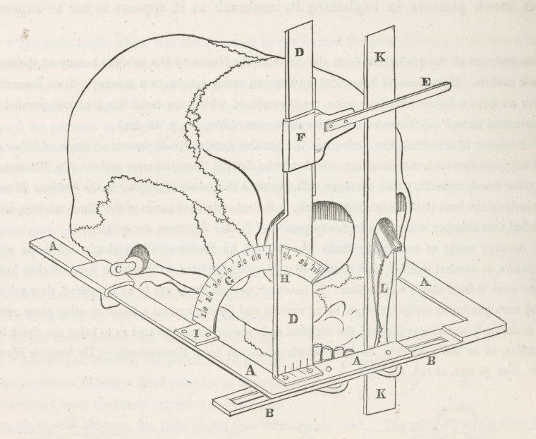 Measurements