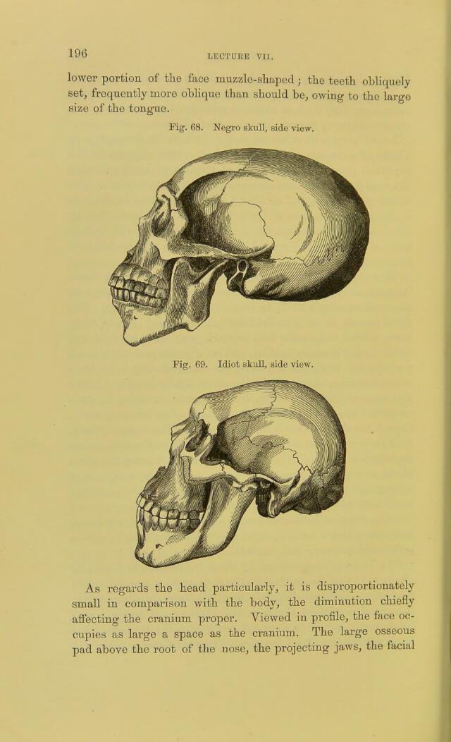 Skulls