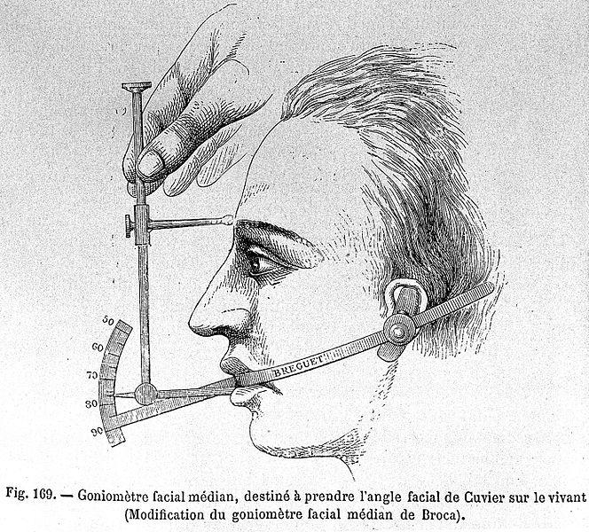 Facial goniometer illustration from Paul Topinard