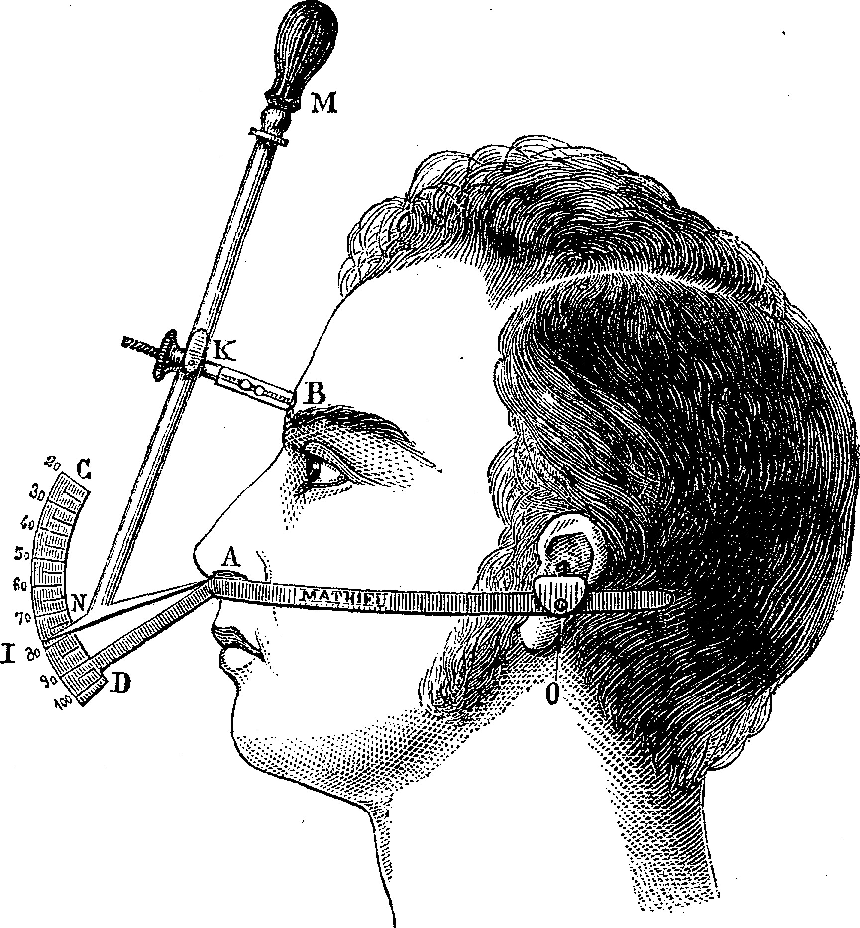 illustration of median facial goniometer